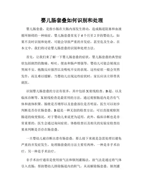 婴儿肠套叠如何识别和处理