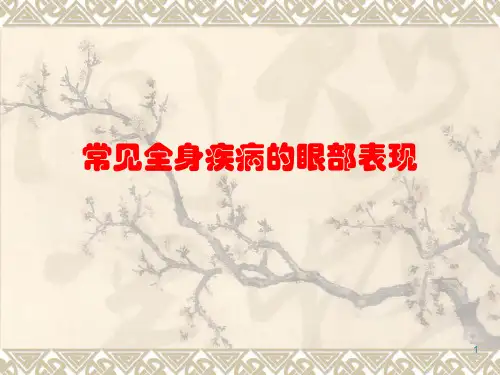 常见全身疾病的眼部表现PPT课件