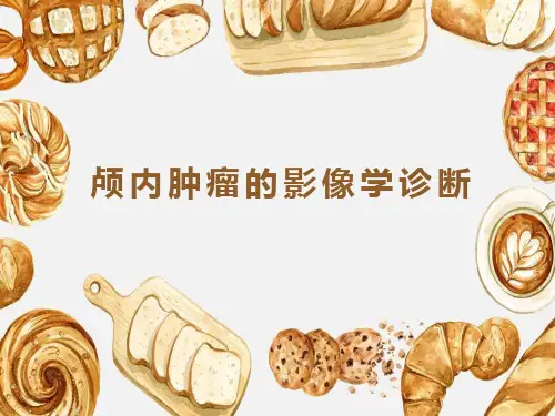 颅内肿瘤的影像学诊断