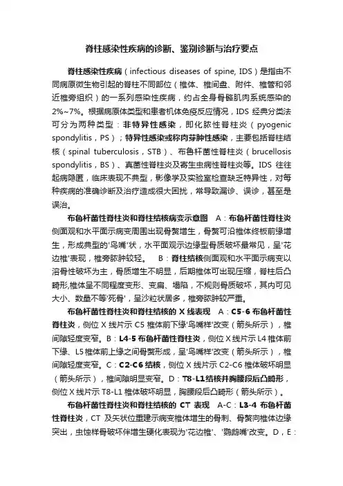 脊柱感染性疾病的诊断、鉴别诊断与治疗要点