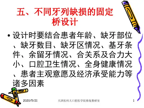 不同牙列缺损的固桥简化设计示例