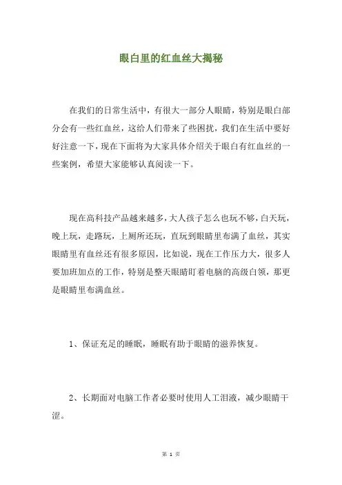 眼白里的红血丝大揭秘