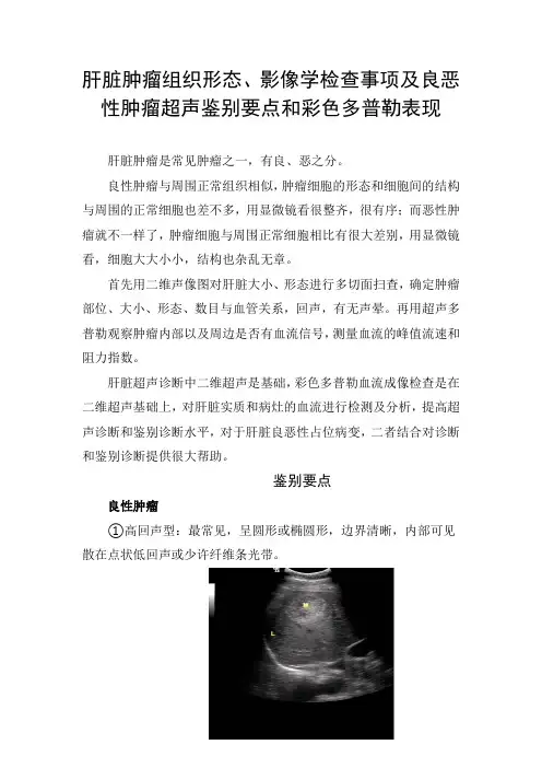 肝脏肿瘤组织形态、影像学检查事项及良恶性肿瘤超声鉴别要点和彩色多普勒表现