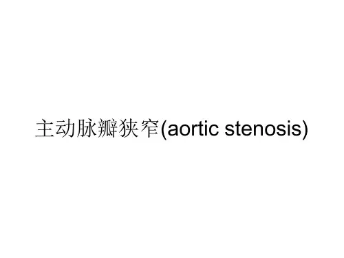 主动脉瓣狭窄(aortic stenosis)