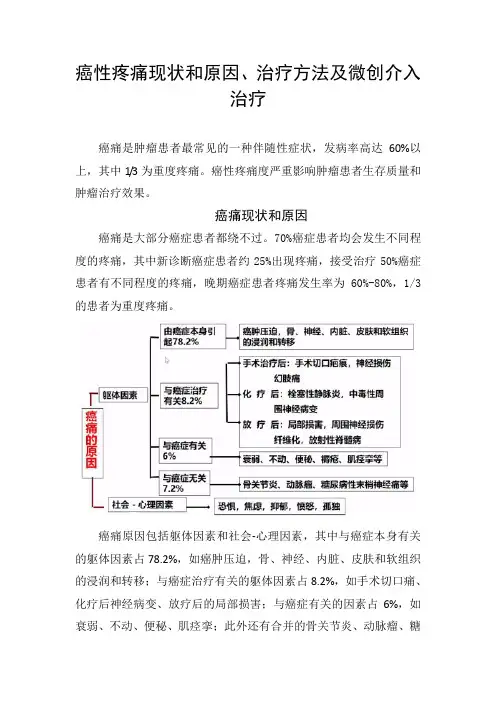 癌性疼痛现状和原因、治疗方法及微创介入治疗