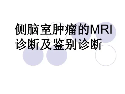 侧脑室肿瘤的MRI诊断及鉴别诊断