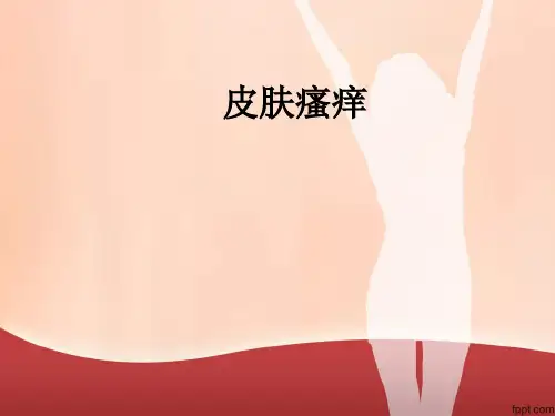 皮肤瘙痒ppt课件