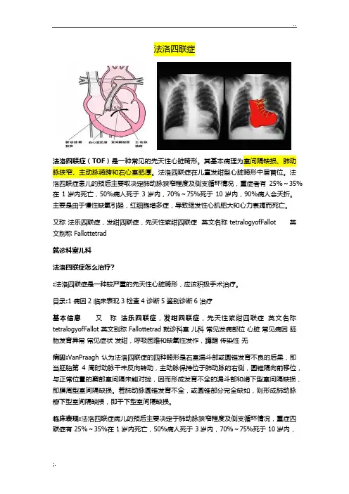 法洛四联症详细图文解惑