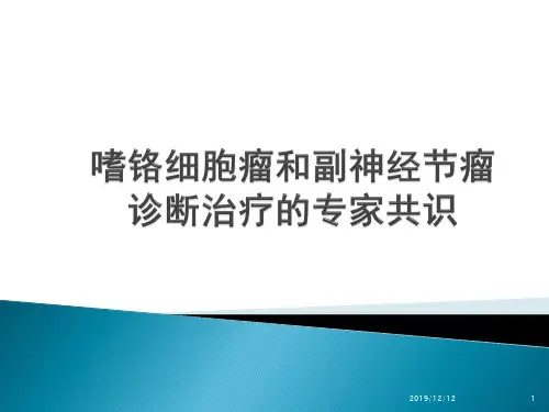 嗜铬细胞瘤共识PPT课件