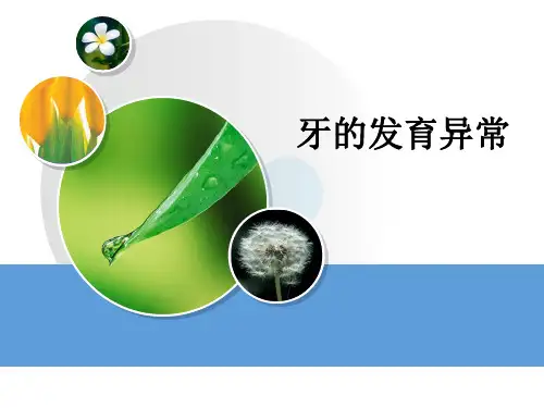 牙的发育异常ppt课件