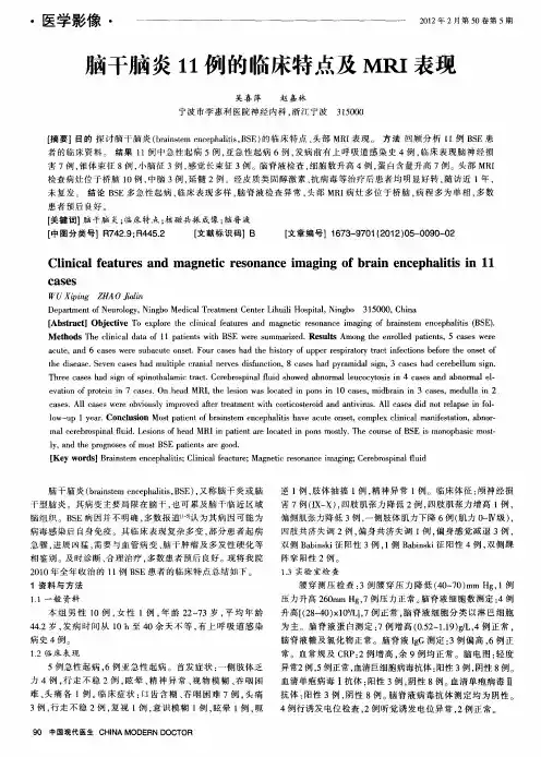 脑干脑炎11例的临床特点及MRI表现