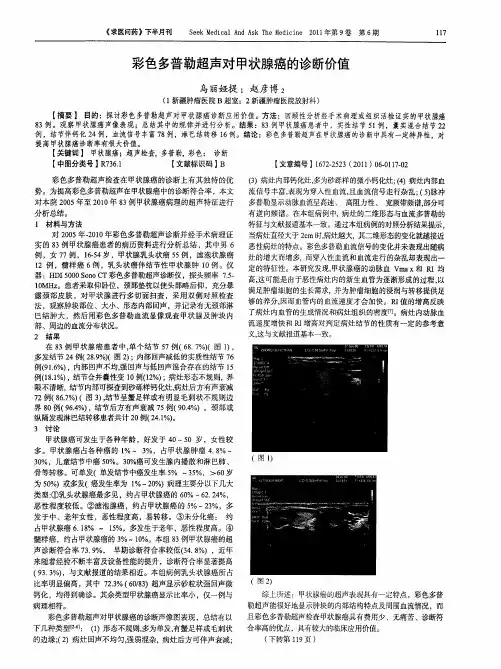 彩色多普勒超声对甲状腺癌的诊断价值