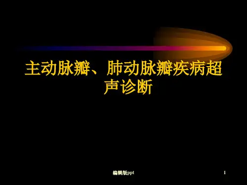 肺动脉瓣疾病PPT课件