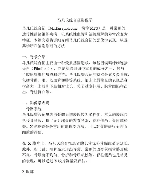 马凡氏综合征影像学
