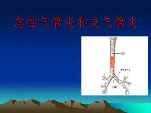 急性气管炎和支气管炎 ppt课件