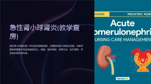 急性肾小球肾炎(教学查房)