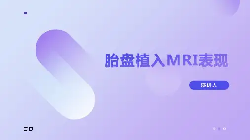 胎盘植入MRI表现