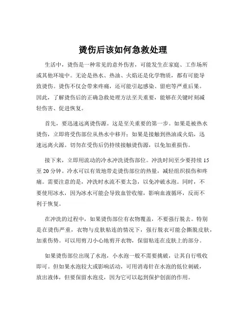 烫伤后该如何急救处理