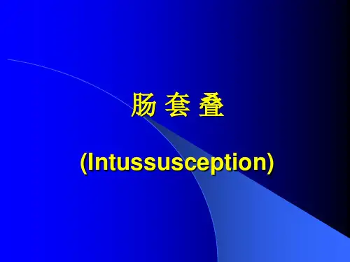 肠套叠