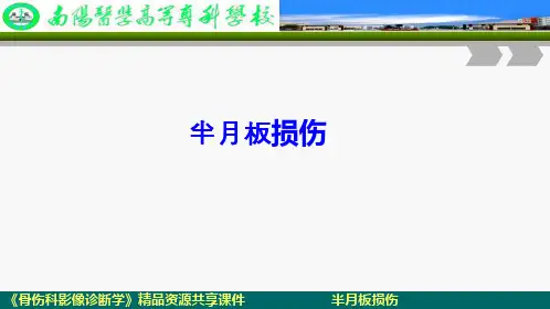 半月板损伤