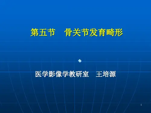 骨与关节发育畸形王培源okppt课件