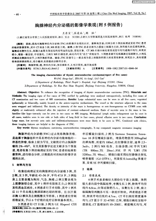 胸腺神经内分泌癌的影像学表现(附5例报告)