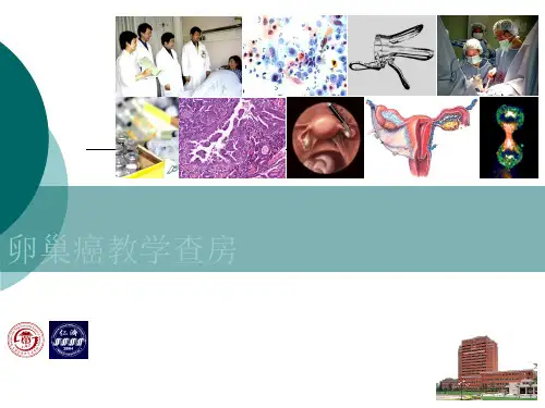 卵巢癌的护理查房(1)