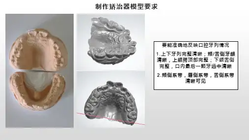 制作矫治器模型要求
