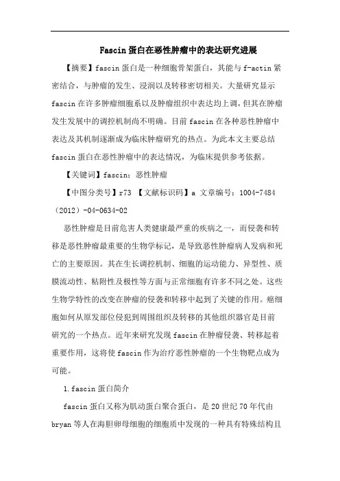 Fascin蛋白在恶性肿瘤中的表达研究进展