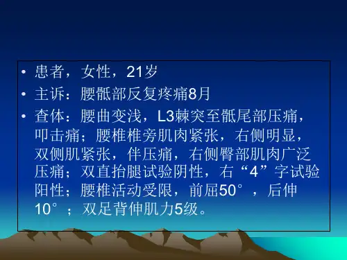 骶髂关节炎