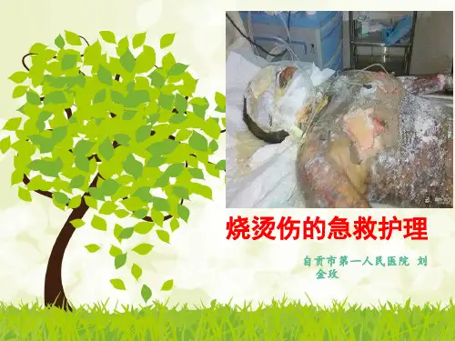 烧烫伤的急救护理