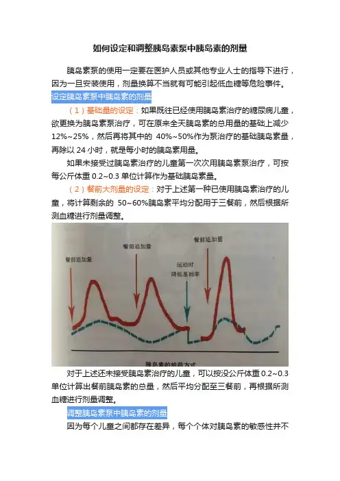 如何设定和调整胰岛素泵中胰岛素的剂量
