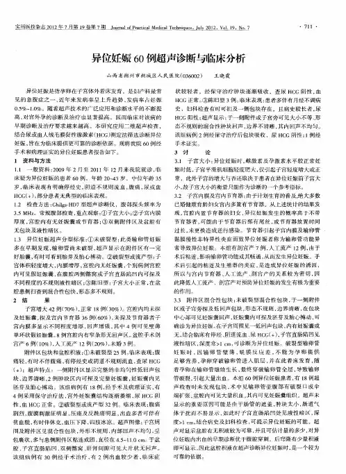 异位妊娠60例超声诊断与临床分析