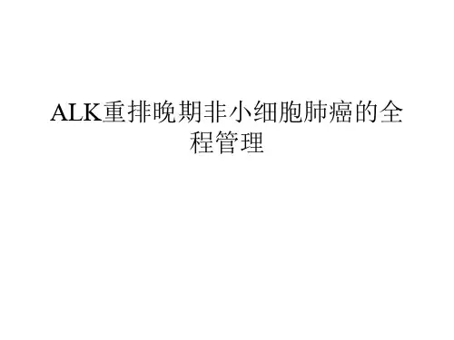 ALK全程管理