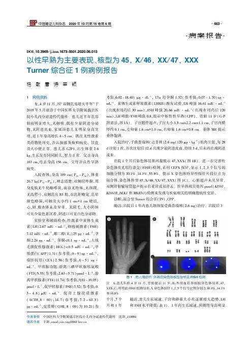以性早熟为主要表现、核型为45,X46,XX47,XXXTurner综合征1例病例报告
