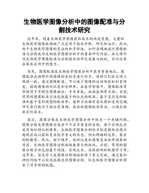 生物医学图像分析中的图像配准与分割技术研究