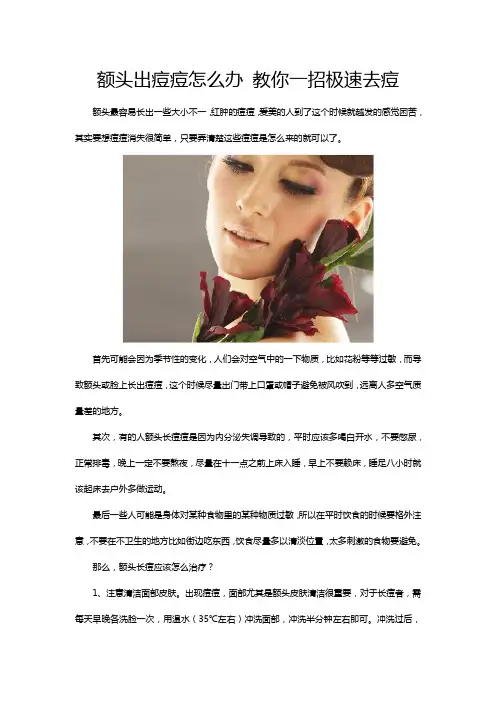 额头出痘痘怎么办 教你一招极速去痘