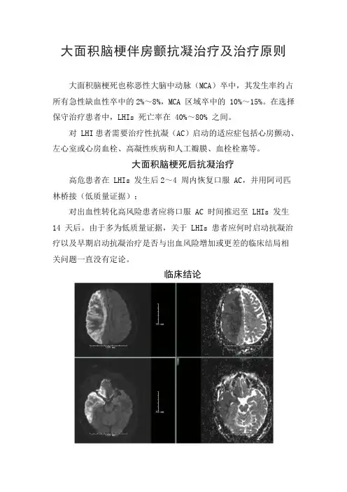 大面积脑梗伴房颤抗凝治疗及治疗原则