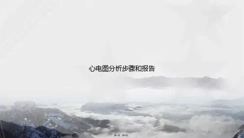 心电图分析步骤和报告讲课文档