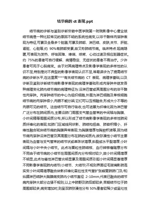 结节病的ct表现.ppt