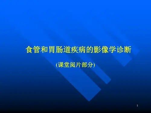 影像诊断 食管PPT医学课件