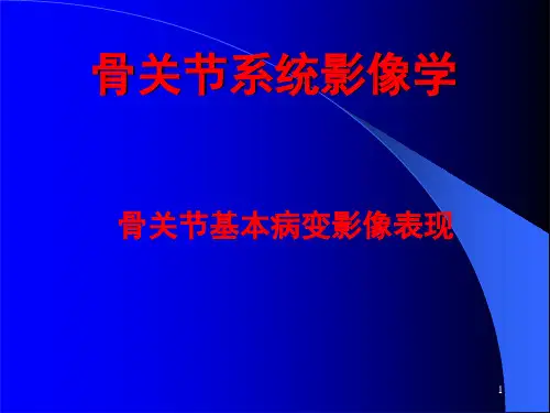 骨关节基本病变影像表现课件