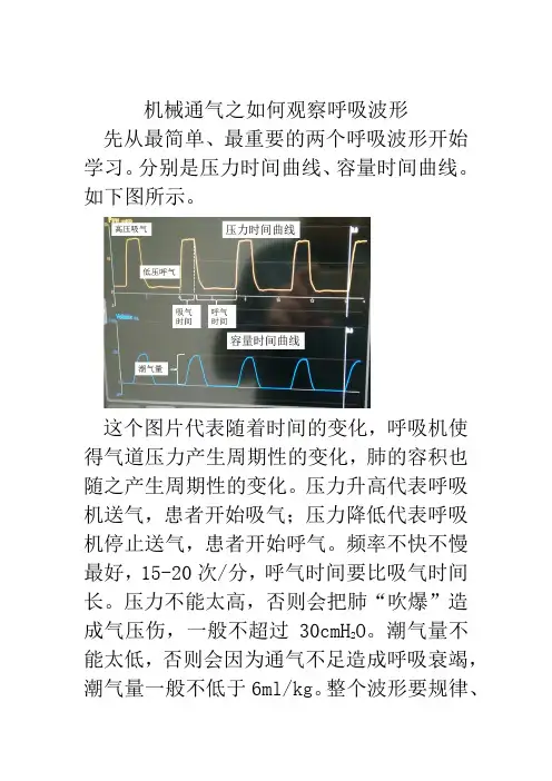 机械通气之如何观察呼吸机波形