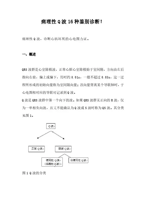 临床心电图-病理性Q波!