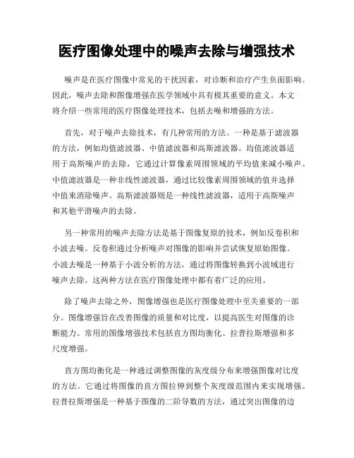 医疗图像处理中的噪声去除与增强技术