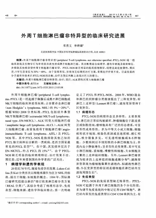 外周T细胞淋巴瘤非特异型的临床研究进展