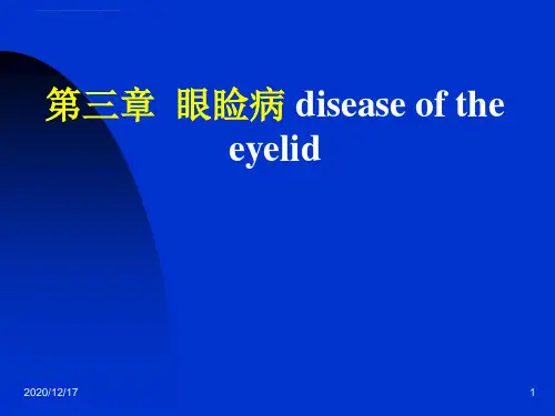 多为金黄色葡萄球菌感染ppt课件