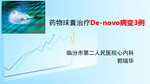 药物球囊治疗DE novo病变3例