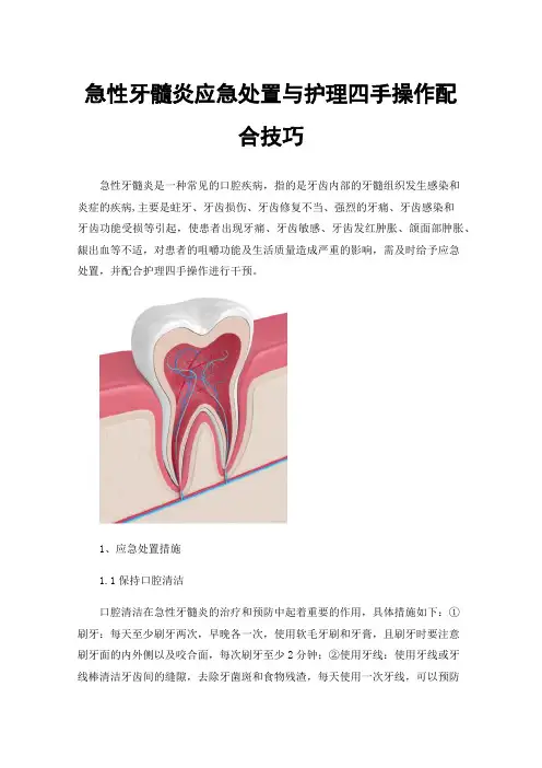急性牙髓炎应急处置与护理四手操作配合技巧