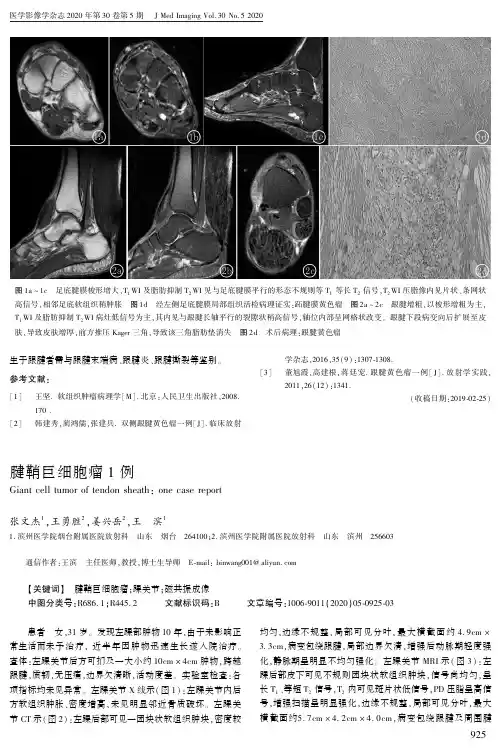 腱鞘巨细胞瘤1例